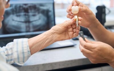 Is a Dental Implant Worth It?